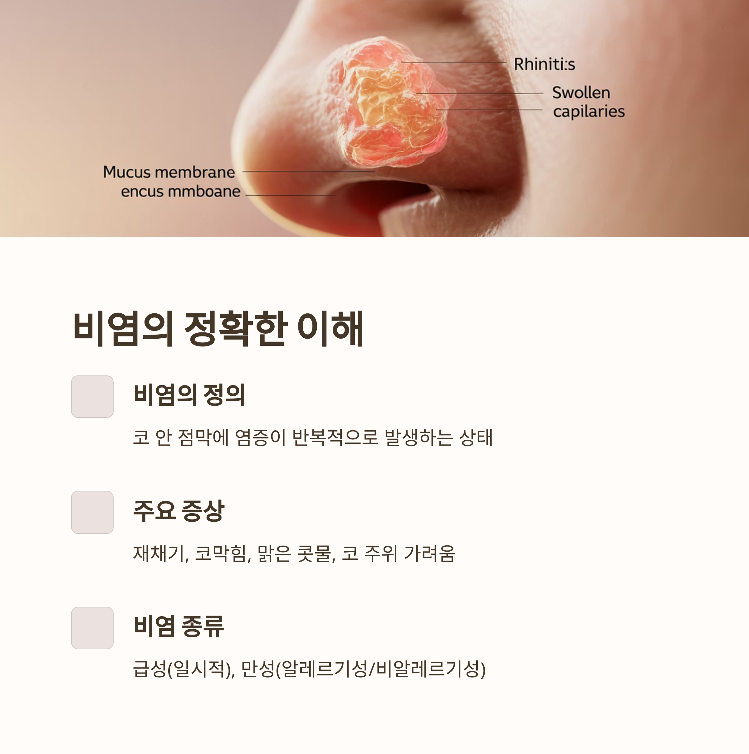비염의 정의, 주요 증상(재채기, 코막힘, 맑은 콧물 등), 비염의 종류를 설명한 인포그래픽 이미지