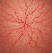 얼굴이 붉어지는 증상