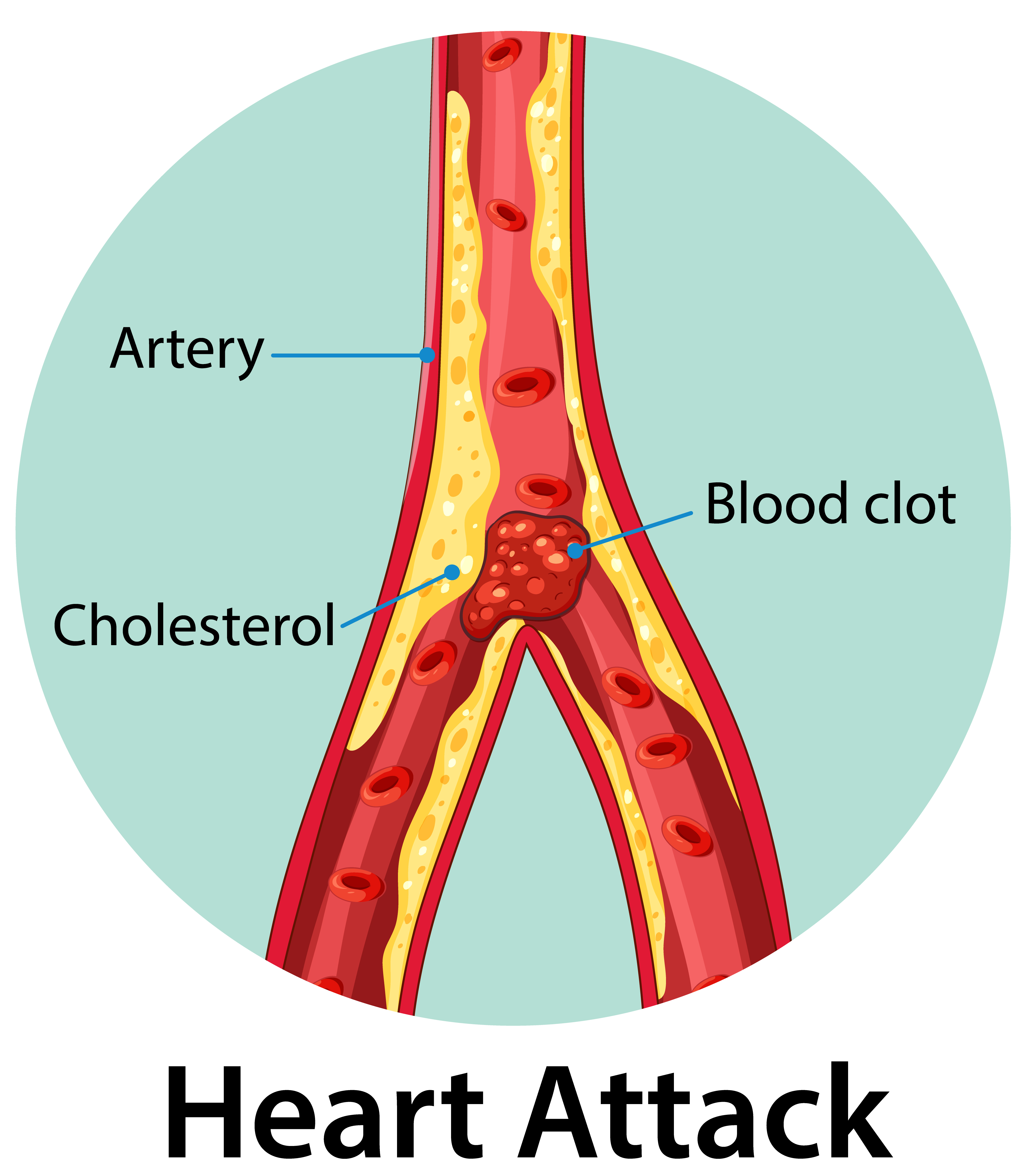 혈관 나이 확~ 낮추는 BEST 3