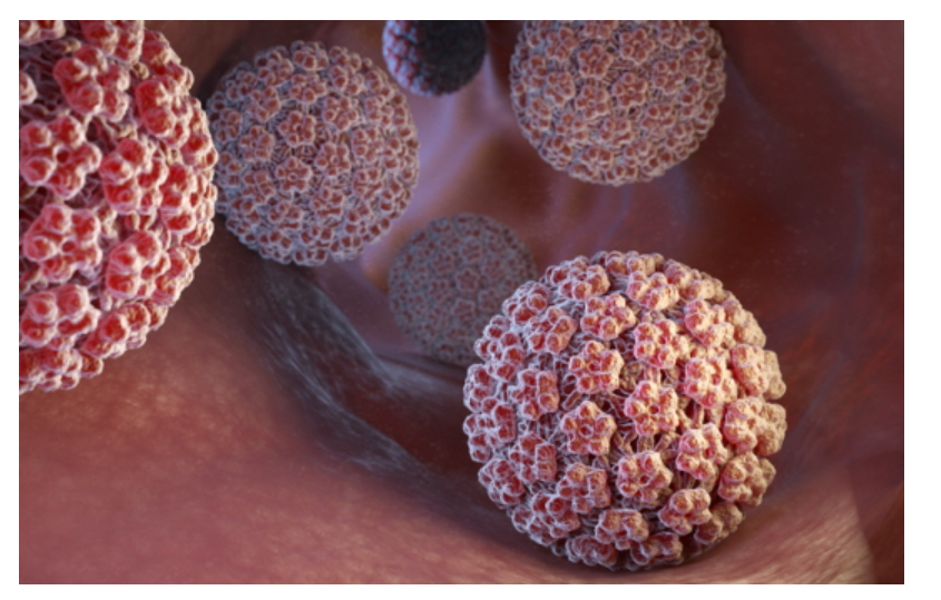 HPV 바이러스