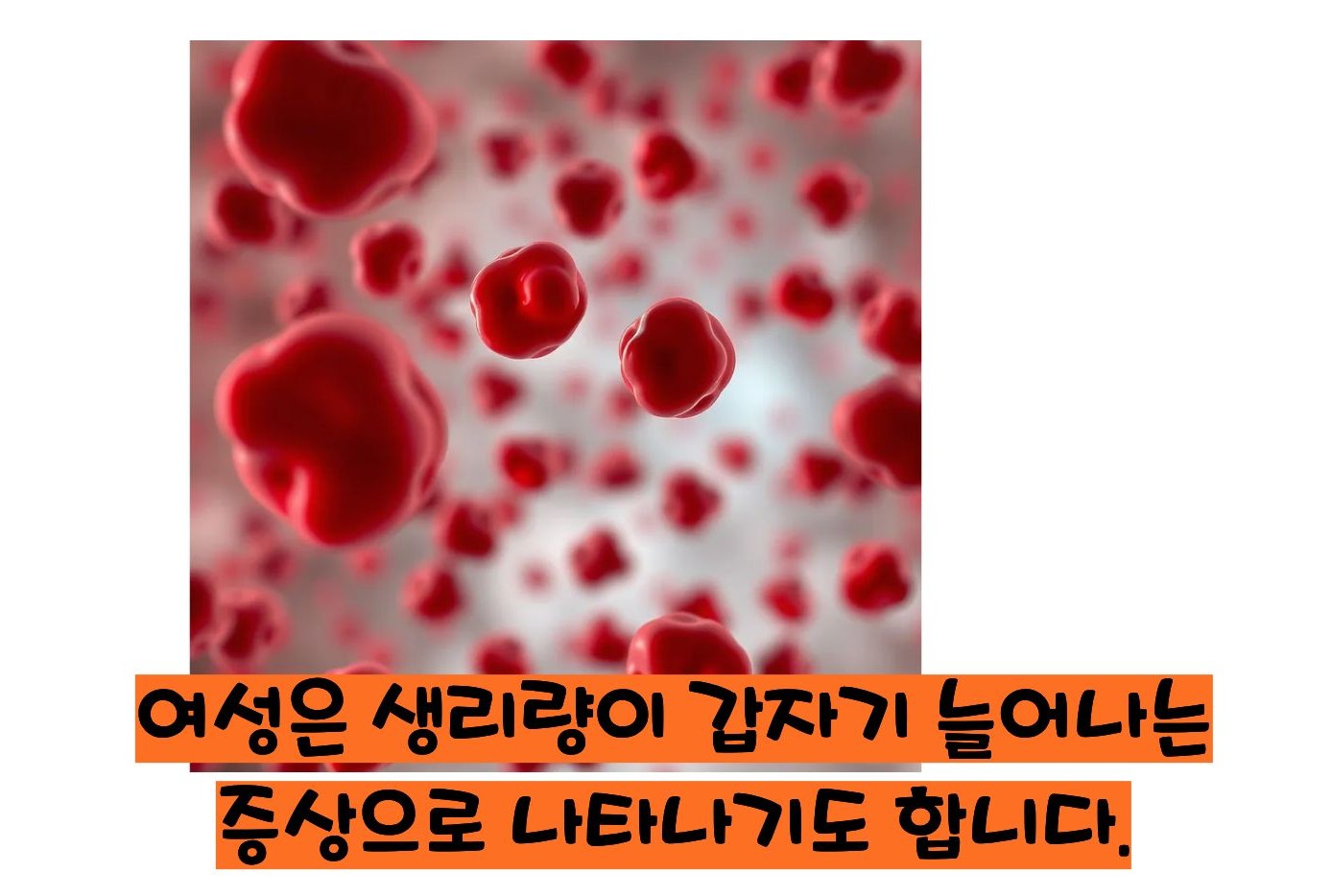 혈소판 감소증 증상