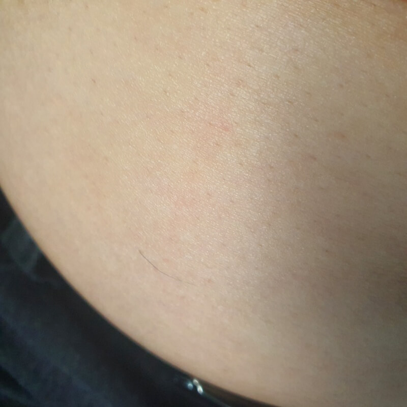 튀어나온-허리-복부