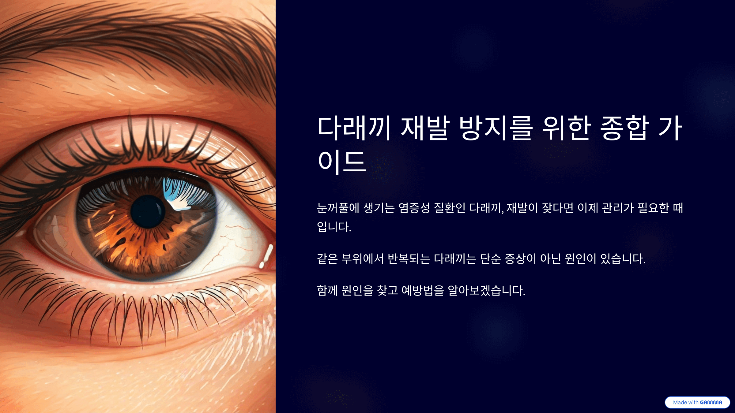 다래끼 원인 및 예방법 