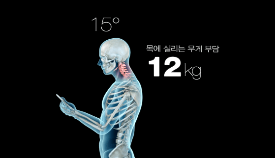 거북목 발생2