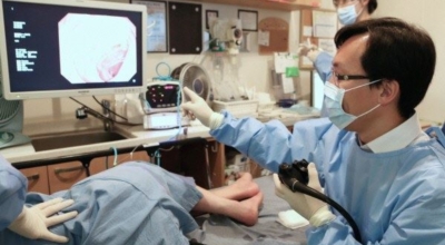 대장내시경이미지