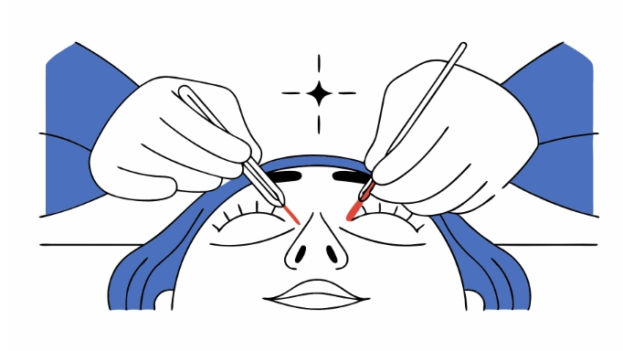뒤트임 수술 과정