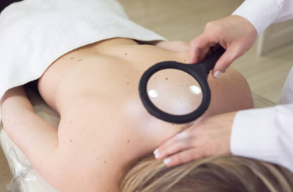 쥐젖 제거방법, 쥐젖이 생기는 이유, 제거 연고 총정리 (2024ver)