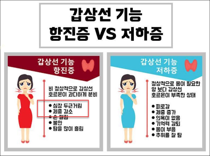 갑상선기능항진증 체중감소