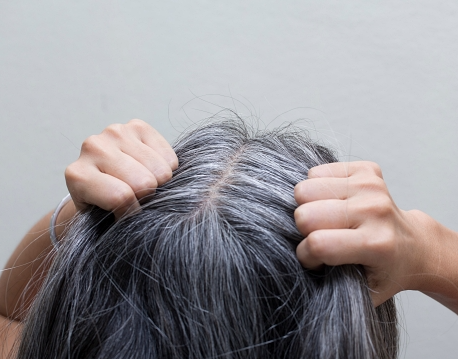 흰머리 나는 이유