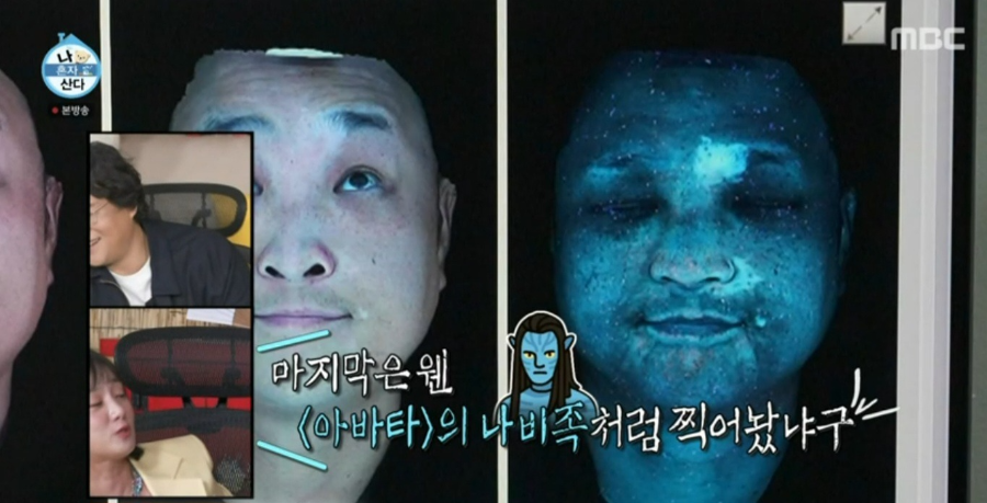 ‘나 혼자 산다’ 구성환의 백반증 투병 이야기