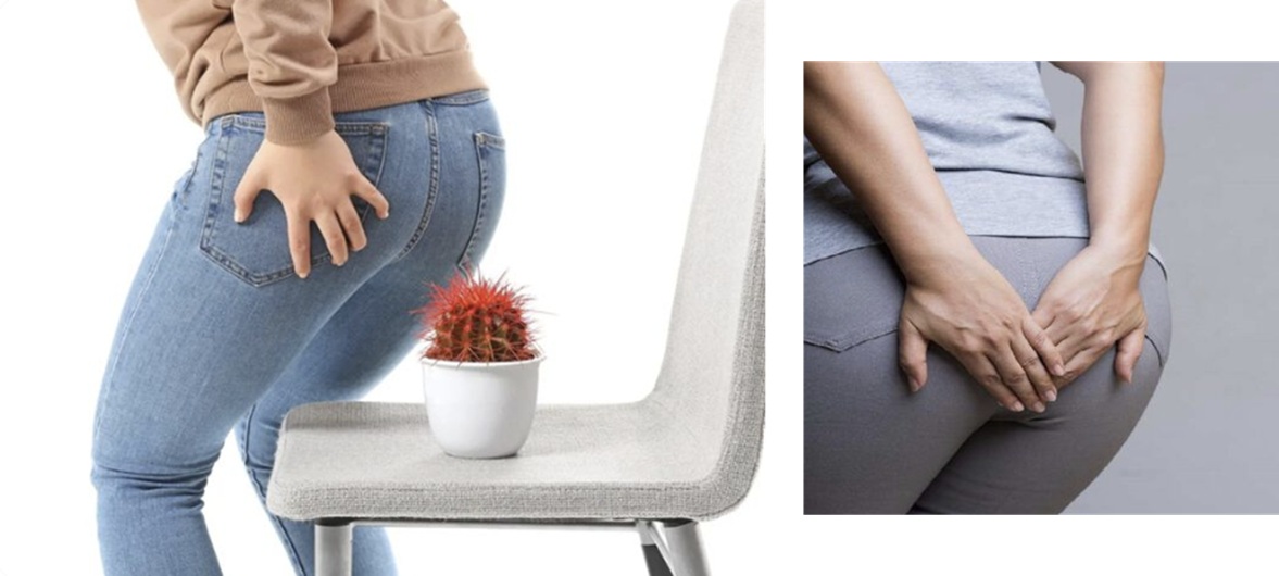 치질 약국 병원