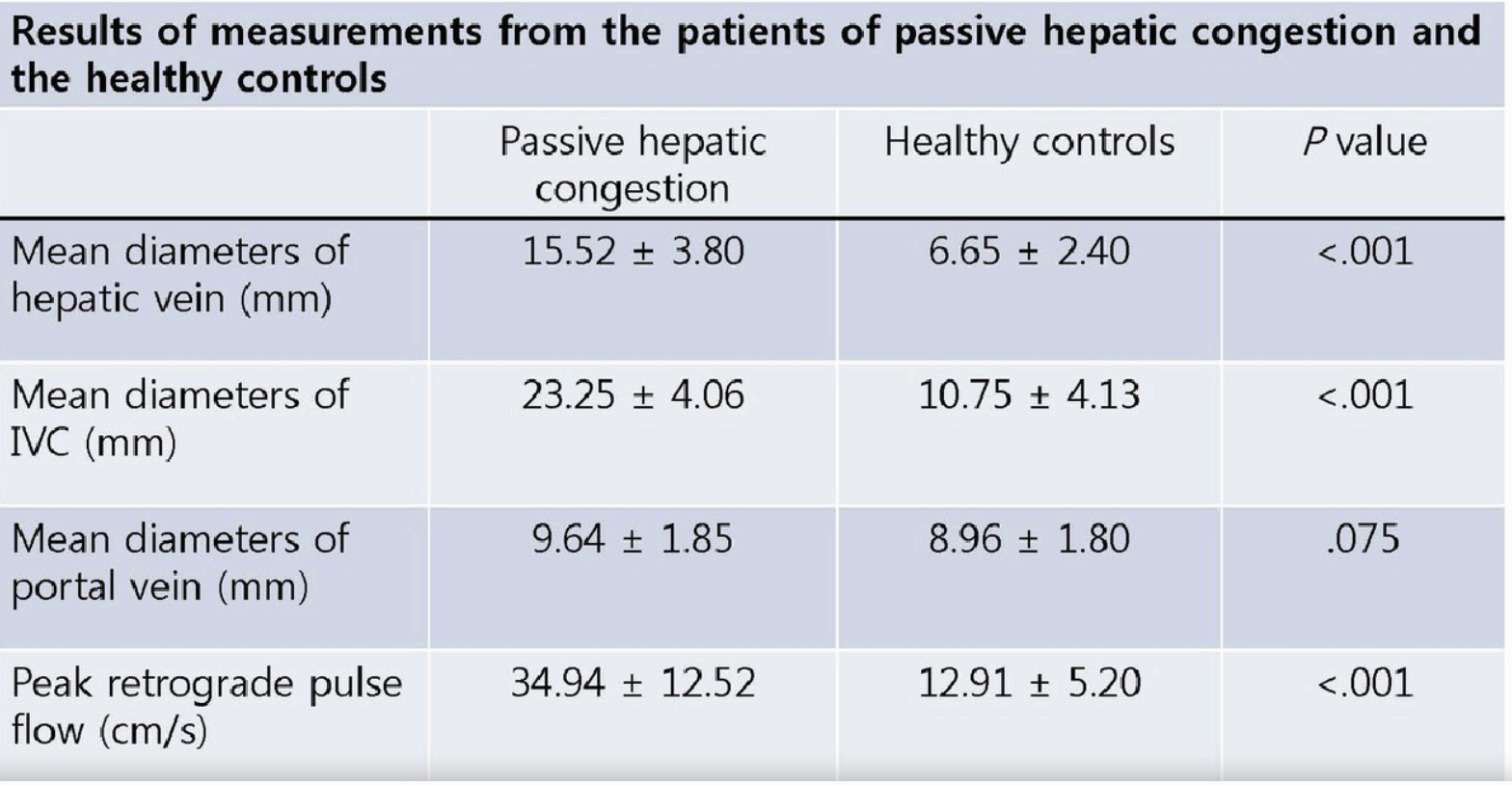 울혈간 (Passive congestion liver)