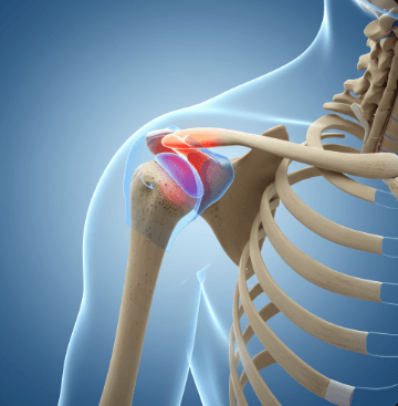오십견 증상 자가진단 및 대응 방법3