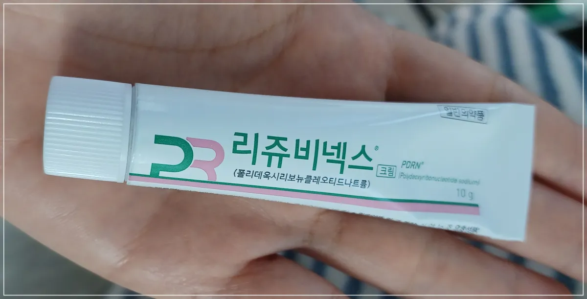 리쥬비넥스-실물크기-손바닥