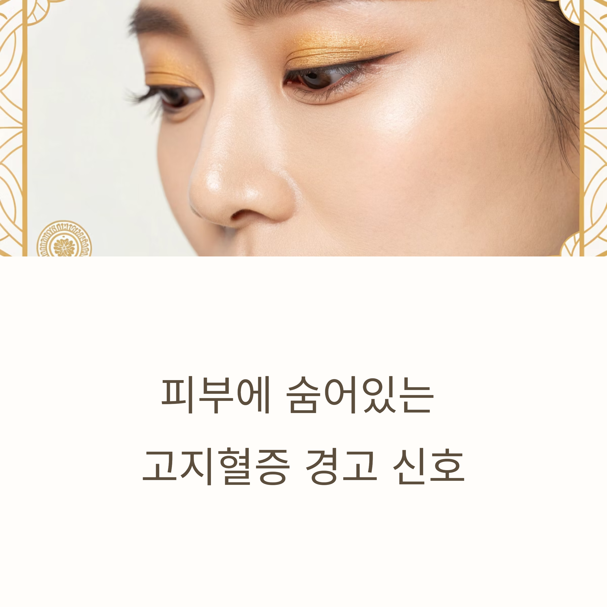 피부에 숨어있는 고지혈증 경고 신호