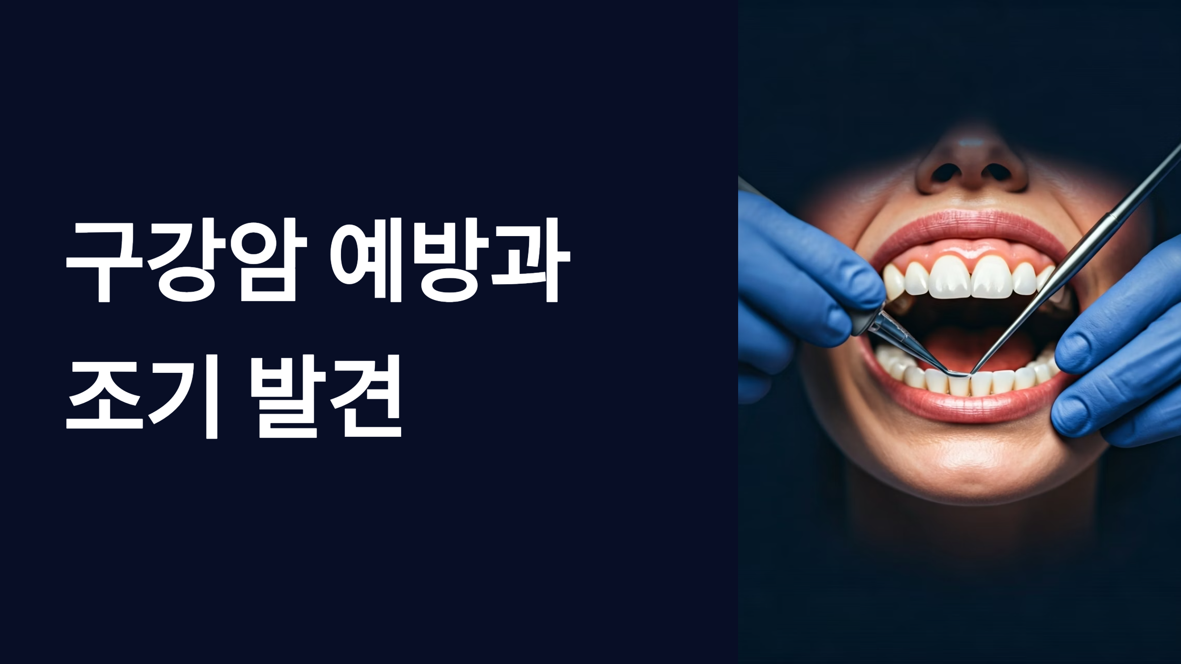 구강암 예방과 조기발견 대표이미지