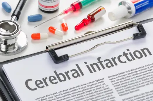 뇌경색 초기증상&amp;#44; 원인 및 치료 방법
