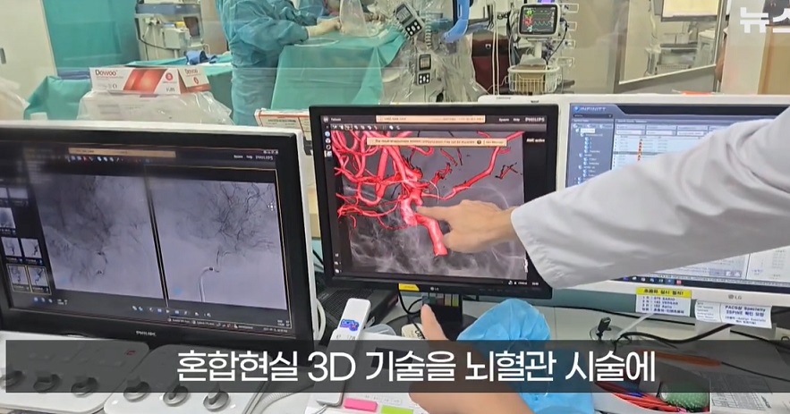 뇌혈관3D모델