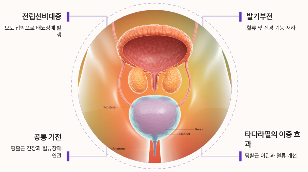 전립선비대증과 구구정의 이중 효과 정리 이미지