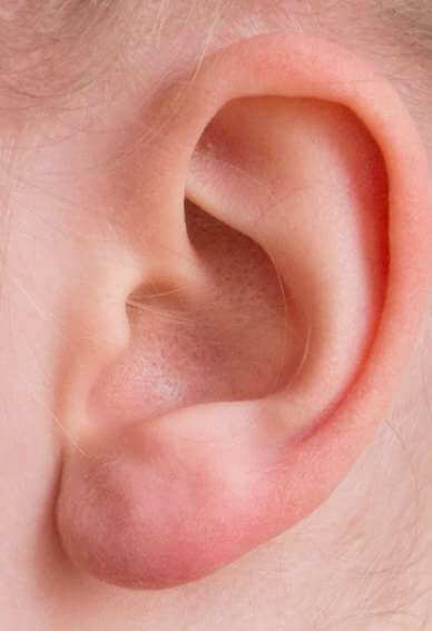 갑자기 귀에서 삐소리 나는 이유