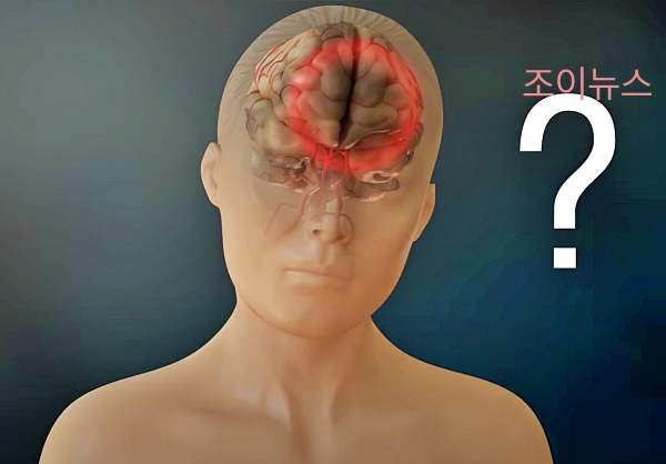 갑상선 기능 저하증 증상인 기억력 감퇴_출처: EBS 다큐 유튜브