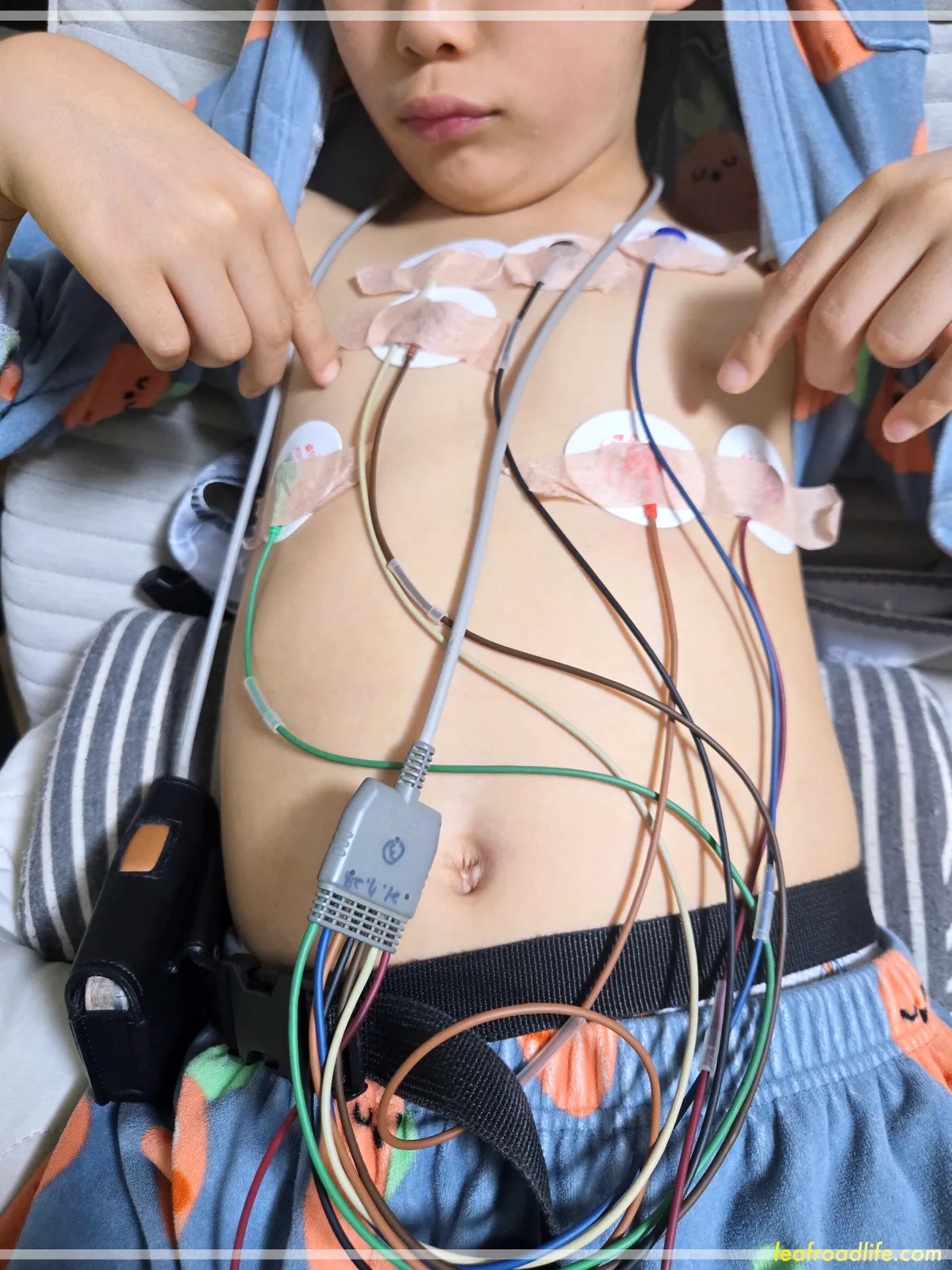 24시간-홀터-검사-받는-아들-사진