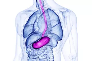 역류성-식도염-증상