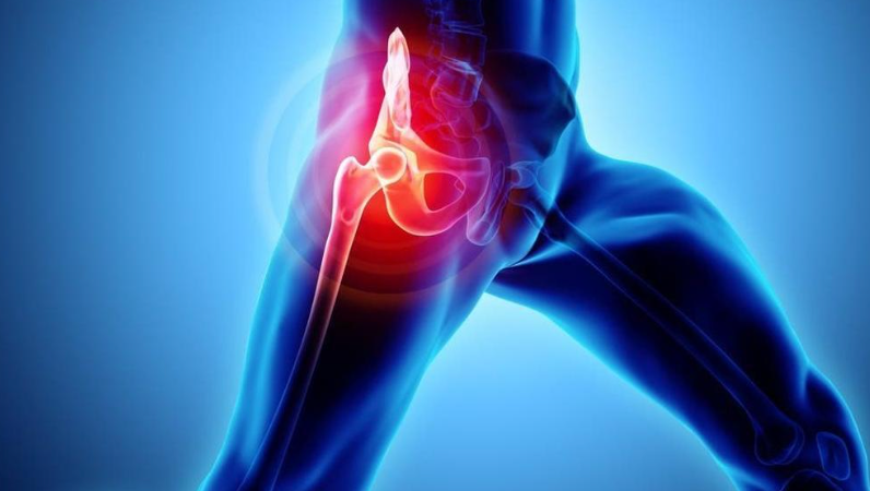 고관절 통증