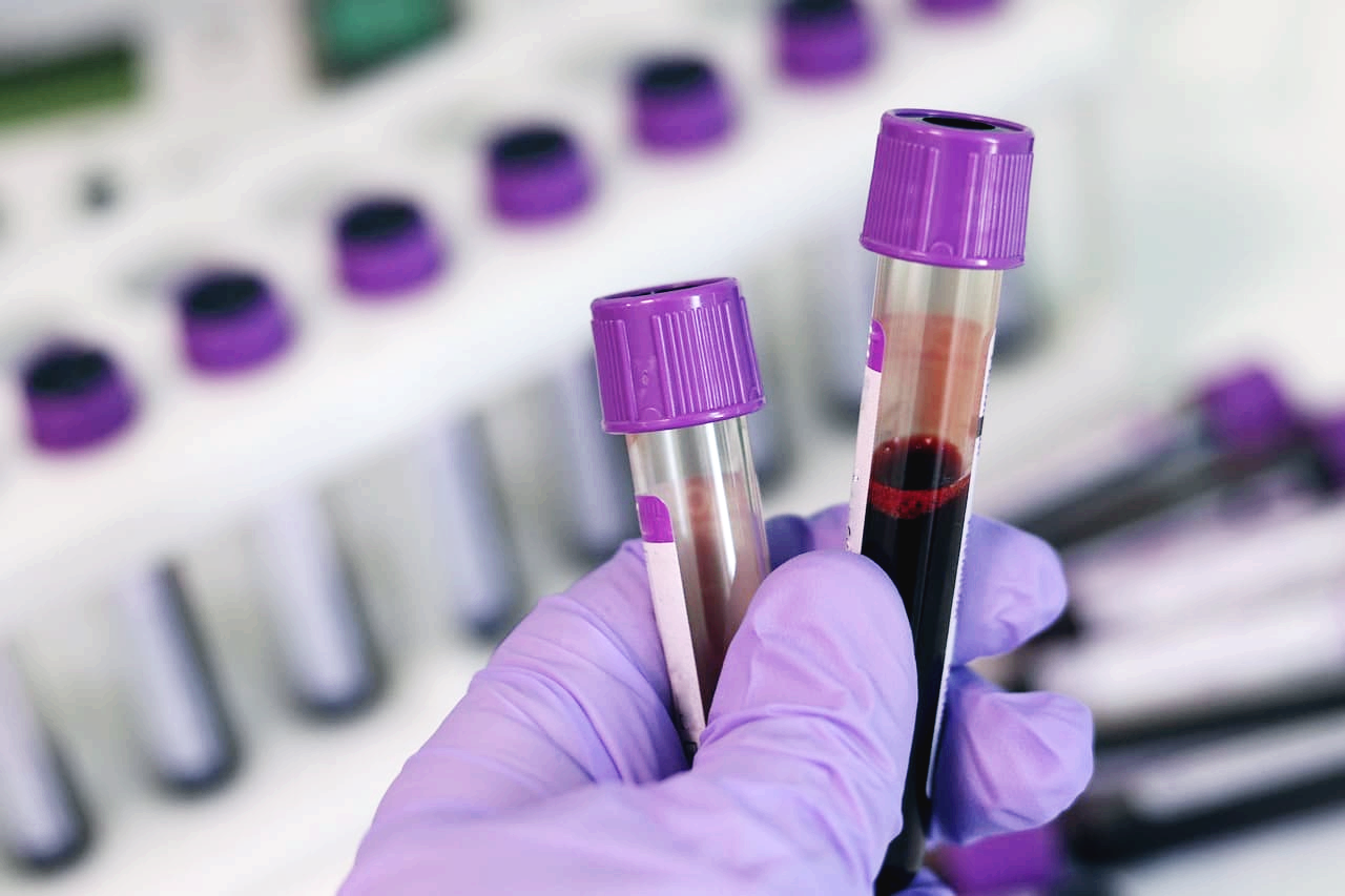 임상병리학; 혈액 검사, 실험실에서 어떻게 분석될까?