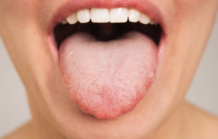 구내염 원인 치료법 구내염에 좋은 음식 증상 전염성