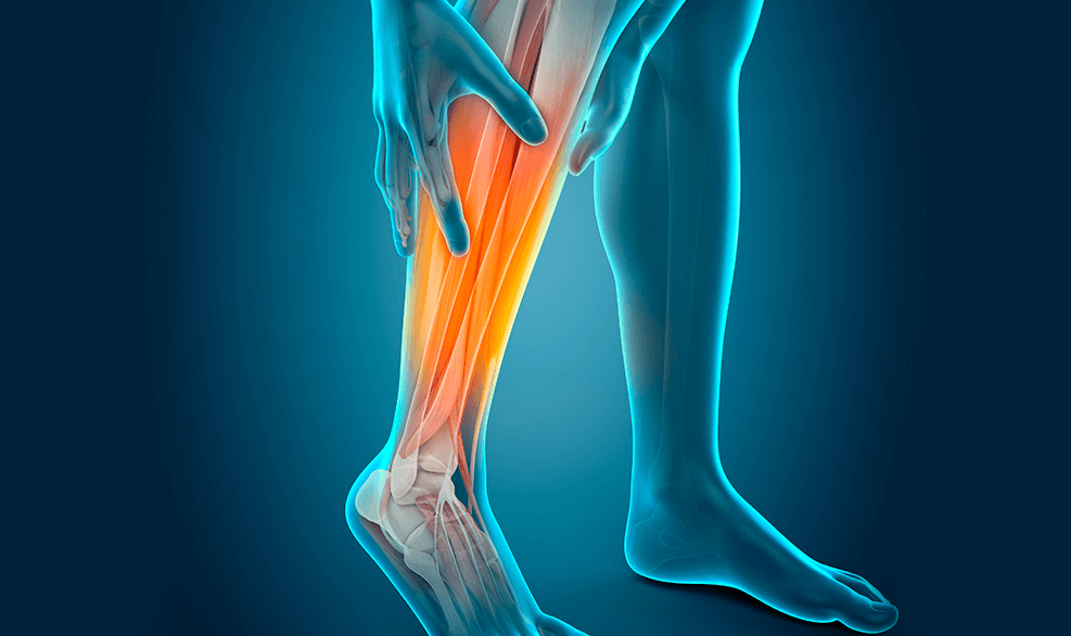 종아리-피로도를-보여주는-사진