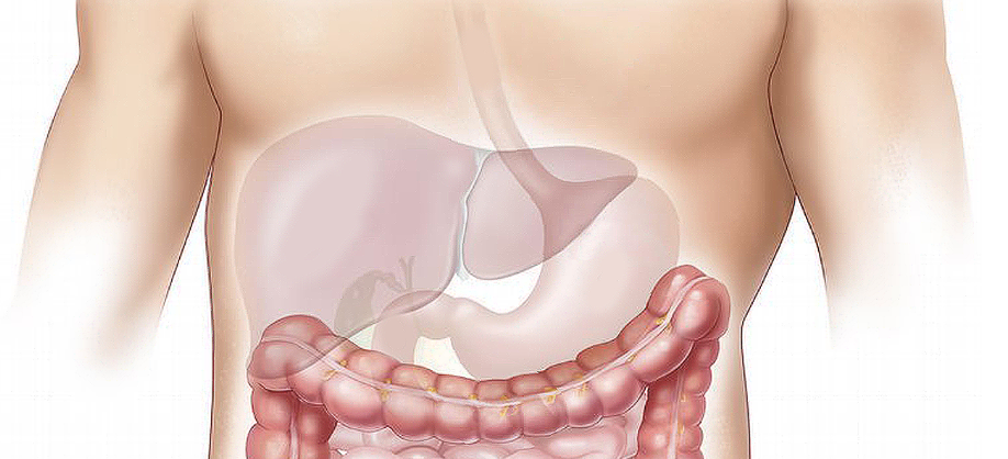 역류성식도염 원인과 예방법 총정리