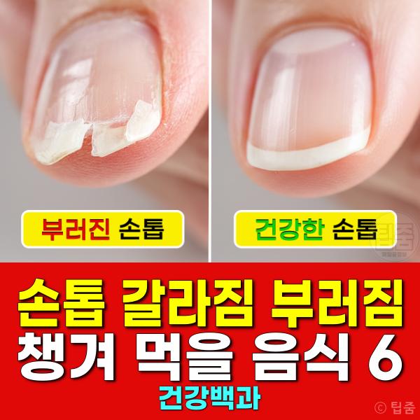 손톱 갈라지고 부러질때 챙겨 먹을 음식 영양소