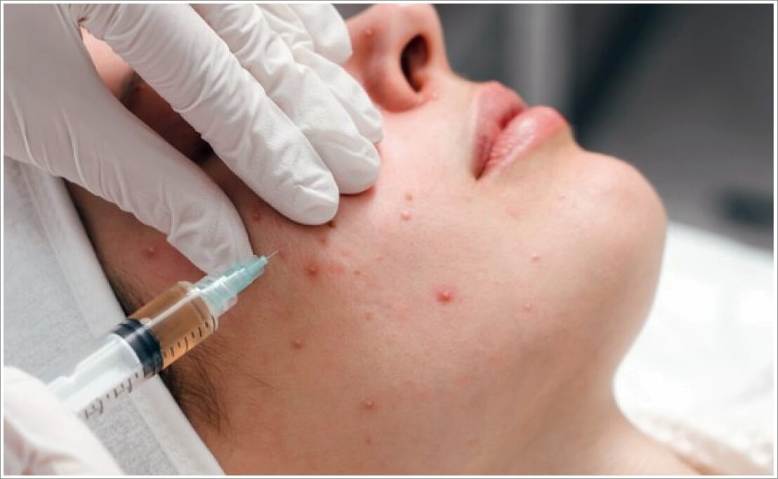 염증에 좋은 음식과 나쁜 음식