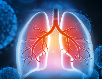 폐암