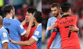 손흥민 안와골절 마스크