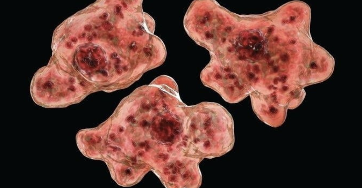 '뇌 먹는 아메바'