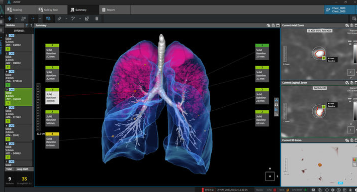 25.02.09(일) 관심 가져볼 의료AI 골든크로스 종목(20일선 60일선 돌파)