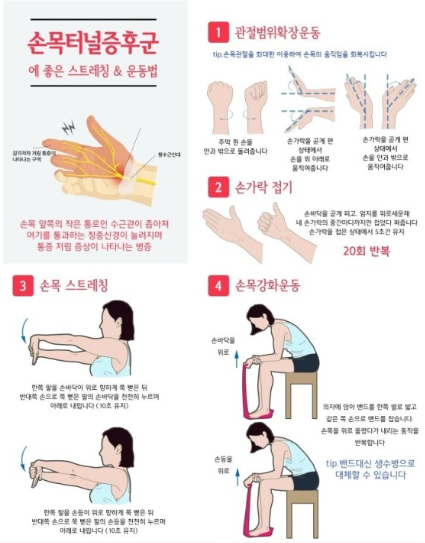 손목터널증후군 스트레칭 사진