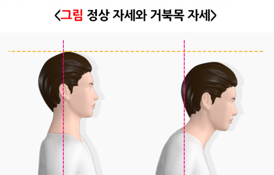 거북목 자세