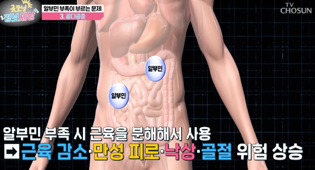 중증건강센터-알부민-수치-올리는법