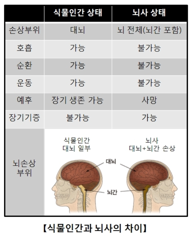 뇌사