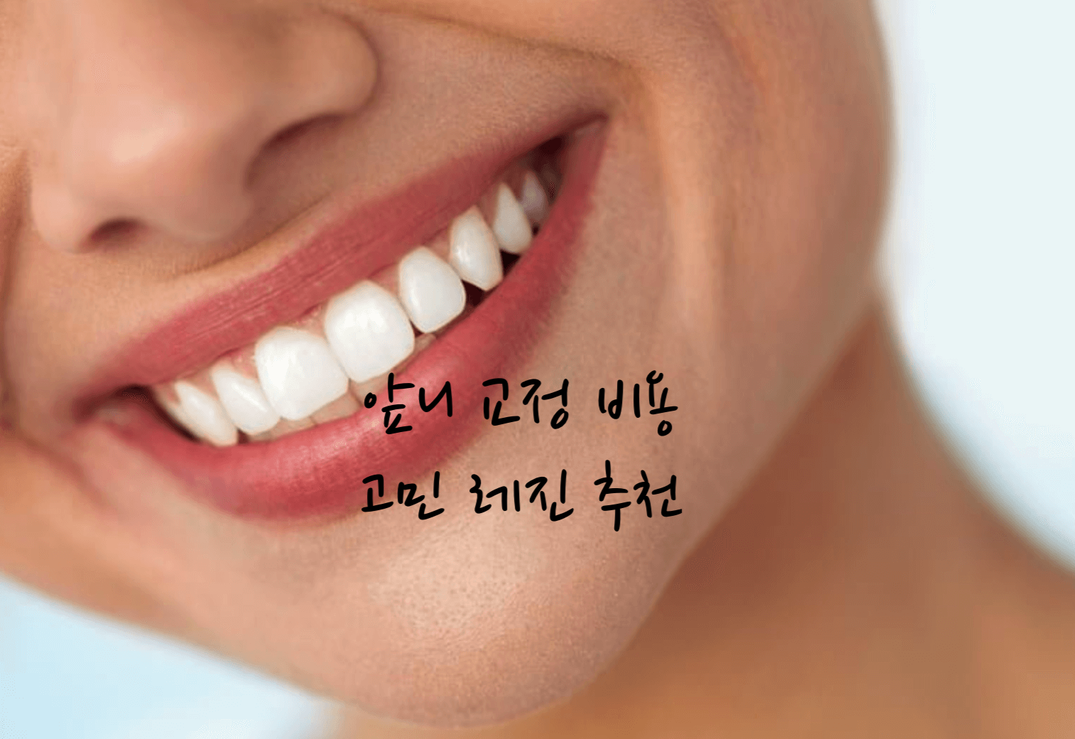 앞니 교정 비용