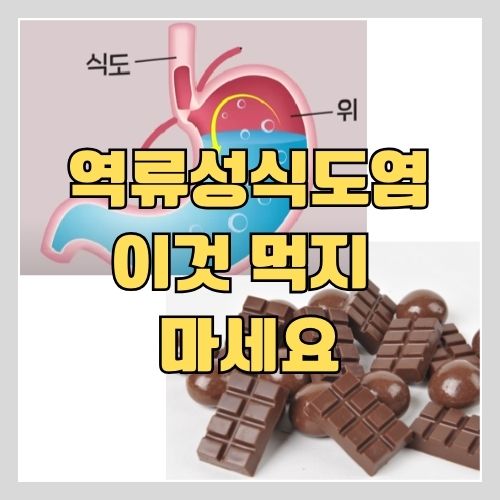 한의사가 알려주는 역류성식도염에 나쁜 음식 제발 이 음식 먹지 마세요!