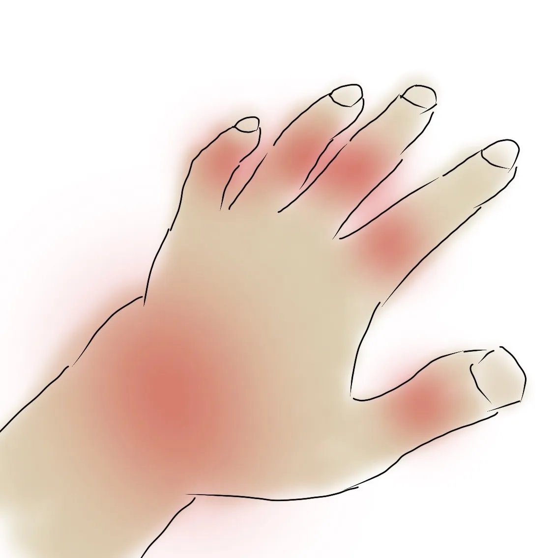 관절염-초기-증상-나도-모르게-찾아온다!-무릎-통증-30대-40대-관절염-자가-진단-및-치료법!