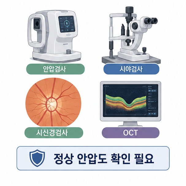 안압검사와 시야검사, 시신경검사, OCT를 통해 녹내장을 확인하는 과정을 보여주는 그림