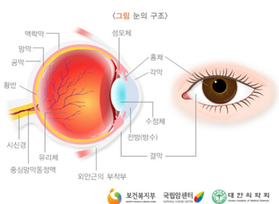 망막색소변성증의 유전적 원인, 증상,예방, 관리법 관련 이미지