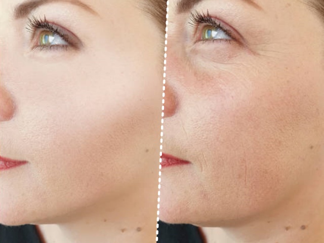 30대 후반 여성 급노화, 얼굴 주름살, 피부관리, 자기관리, 건강 뷰티 팁줌 매일꿀정보