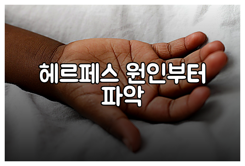 헤르페스 원인부터 파악