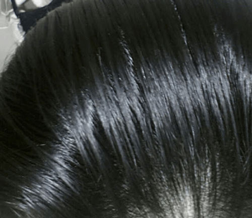 기름진머리카락